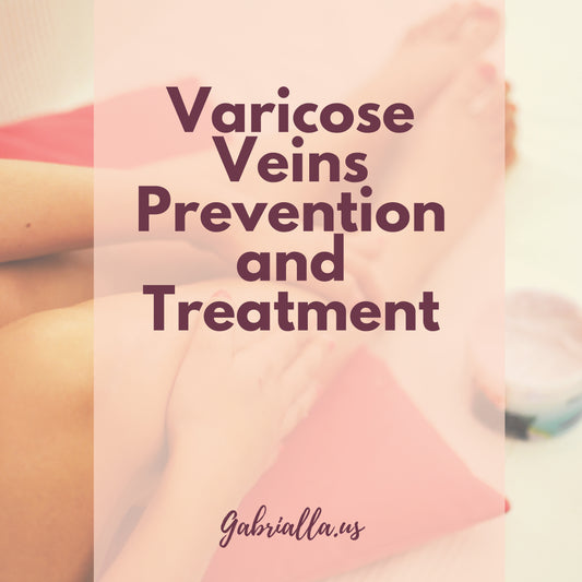 varicose veins treatment